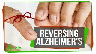 Researchers Reverse Alzheimer’s Memory Loss in Mice  SciShow News [upl. by Berkeley]