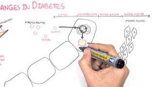 Diabetes Complication and Pathophysiology of the complication [upl. by Eatnad]