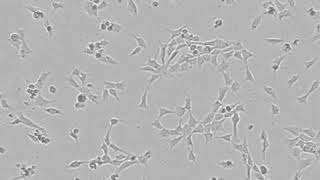 iPSC derived neural crest cell proliferation timelapse  Using CytoSMART Lux2 livecell imager [upl. by Mcmahon719]