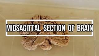 Midsagittal Section of Brain  neuroanatomy [upl. by East211]