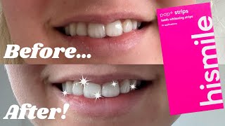 HiSmile Teeth Whitening Strips  Better than Oral B 3D whitestrips [upl. by Ellenid]