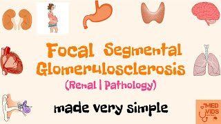 Focal Segmental Glomerulosclerosis  FSGS  Renal system  Pathology  Med Vids made simple [upl. by Zerk]