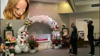 Adalia Rose last journey video Adalia Rose has passed away [upl. by Fredela]