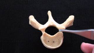 Typical Vertebra  Spinal column  Anatomy [upl. by Hameerak]