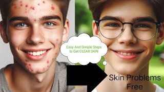 How to Get Clear Skin SkinMaxxing PART 2 quotHow I Cleared My Skin Fast No Expensive Productsquot [upl. by Ness211]