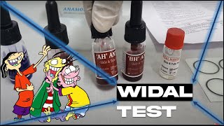 WIDAL TEST  SLIDE AGGLUTINATION TEST  TYPHOID FEVER  MICROBIOLOGY  MBBS  REVISION [upl. by Nnyrat]