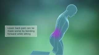 Lumbar Spondylosis Symptoms [upl. by Idarb]