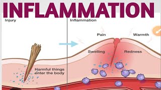 INFLAMMATION  TYPES  CAUSES  PATHOPHYSIOLOGY  SYMPTOMS  TREATMENT [upl. by Fafa]