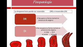 Anemia de celulas falciformes [upl. by Jehiel749]