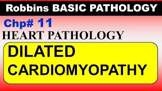 Chp11 Robbins Patho  Heart Pathology  DILATED Cardiomyopathy  Dr Asif Lectures [upl. by Enellek]