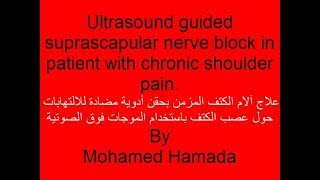 Ultrasound Guided suprascapular Nerve Block [upl. by Hairabez]