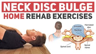 Neck Disc BulgeHerniation Rehab Exercises [upl. by Sankey146]