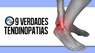 9 verdades sobre las tendinopatias o tendinitis que debes saber [upl. by Ariay]