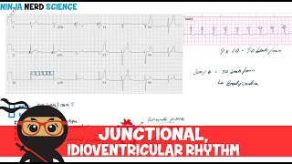 Rate and Rhythm  Junctional and Idioventricular Rhythm [upl. by Norvin374]