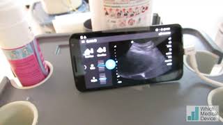 Nephrostomy with your smartphone [upl. by Anehs]