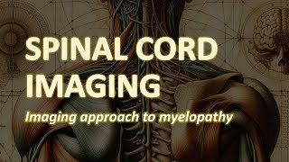 Spinal Cord Imaging Imaging approach to Myelopathy [upl. by Archaimbaud]