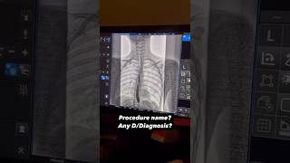 Name The Procedure shorts radiology xray trending viral [upl. by Anida363]