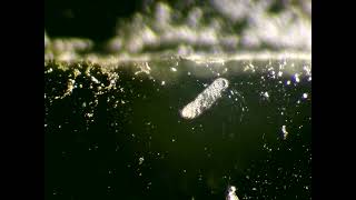 Protists and a bdelloid  rotifer  Raw vid II [upl. by Akibma]