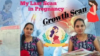 What is Growth scan  My Last Scan Experience suger CBC testbaby underweight😭 pregnancy youtube [upl. by Nomyaw]