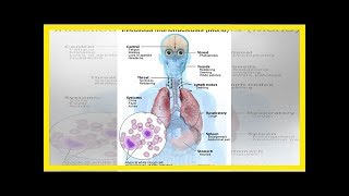 Haupthilfsmittel für Mononucleosis [upl. by Oniratac]