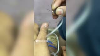 Butterfly Cannulation  butterfly scalp fixed  intravenous Cannulation [upl. by Karas]