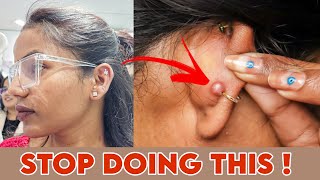 STOP getting EarNose Piercing Infection Again  100 Result  Ravinaa Gupta [upl. by Eyahc386]