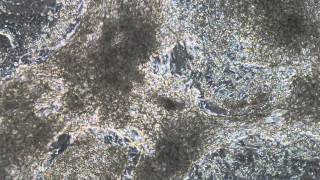 Video of beating cardiomyocytes [upl. by Einnod]