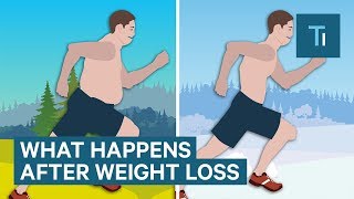 What Losing Weight Does To Your Body And Brain  The Human Body [upl. by Nnaitak352]