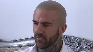 Scalp Micropigmentation Skalptec UK  Skalptec SMP Video Testimonial  Ashley Morris Fitness Model [upl. by Acisey250]