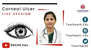 Paramedical Course ∣ Live Class ∣ Corneal Ulcer PII [upl. by Hazrit]