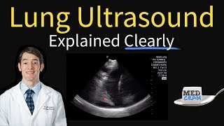 Lung Ultrasound Explained Point of Care Bedside Clinical [upl. by Templa]