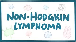 Nonhodgkin lymphoma  causes symptoms diagnosis treatment pathology [upl. by Ruhtracam]