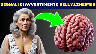 SCIENTIFICO Queste 5 Abitudini Sono Legate allAlzheimer [upl. by Jerrylee135]