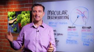 How To Prevent Macular Degeneration – Dr Berg [upl. by Eladal]