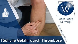 Die tödliche Gefahr durch Thrombose  Ursachen Symptome amp Tipps bei tiefer Beinvenenthrombose TVT [upl. by Argent709]