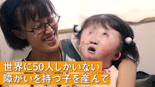 【「こんなかわいい子はいない」】世界的に稀少な染色体異常を持つ子と生きるお母さんの一日 supported by にしたんクリニック [upl. by Lucic]