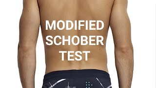 MODIFIED SCHOBERS TEST [upl. by Bubb]