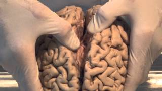 Introduction Neuroanatomy Video Lab  Brain Dissections [upl. by Jessabell]