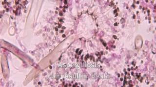 Aspergillus and Aspergillosis [upl. by Nwahsek]