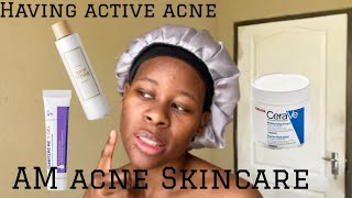 My Simple AM Acne Skincare Routine [upl. by Paxon]