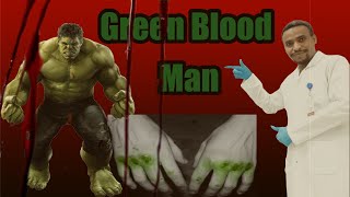 الرجل الأخضرGreen blood man😲😲 [upl. by Blaine]