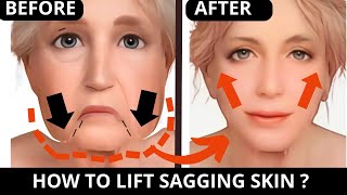 ATTRACTIVE CHISELED JAWLINE EXERCISE  LIFT SAGGY SKIN JOWLS LAUGH LINES FOREHEAD LINES 11 LINES [upl. by Warenne763]