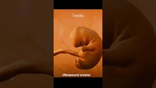 7 Weeks Babybaby doctor pregnant cutebaby health doctors pregnancy ultrasound hospital [upl. by Schoenberg]