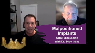 Malpositioned Implants  Dr Scott Ganz [upl. by Schwing]