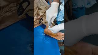 INTRAARTICULAR INJECTION FOR ANKLE PAIN [upl. by Suirad]