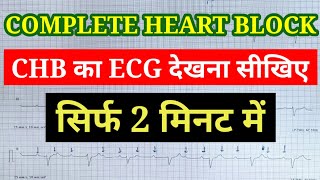 Complete Heart Block का ECG देखना सीखे सिर्फ 2 मिनट में  Learn CHB ECG interpretation in 2 minutes [upl. by Madeline]