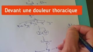 Devant une douleur thoracique [upl. by Royo3]