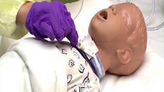 Tracheostomy Suctioning [upl. by Nylodam]