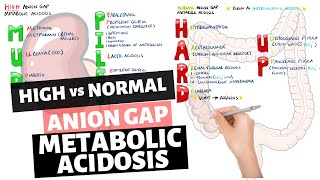 High vs Normal Anion Gap Metabolic Acidosis  Mnemonic MUDPILES amp HARD UP [upl. by Nordine]