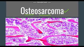 Osteosarcoma GeneralMorphology SubtypesClinical features [upl. by Esertak943]